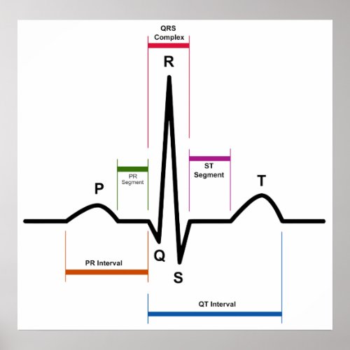 Sinus Rhythm in an Electrocardiogram ECG Diagram Poster