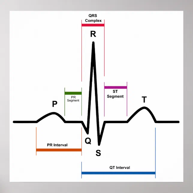 Sinus Rhythm in an Electrocardiogram ECG Diagram Poster | Zazzle