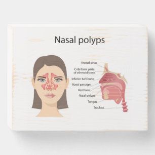 Sinuses on white background wooden box sign