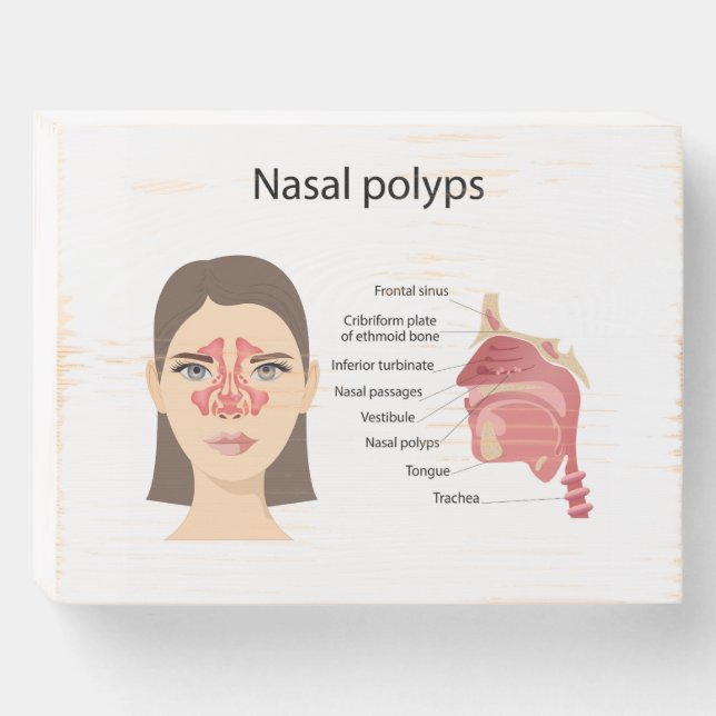 Sinuses on white background wooden box sign (Front Horizontal)