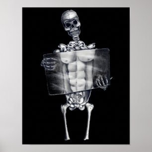 Skeleton Chest Xray Posters