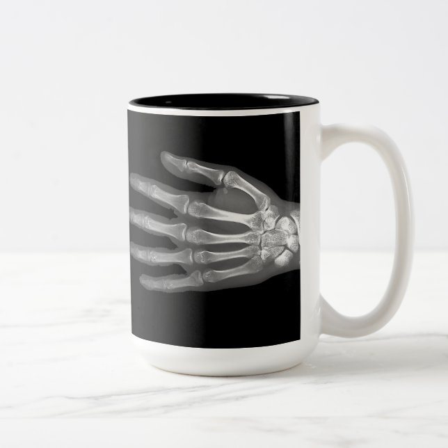 Skeleton Hand X-Ray Two-Tone Coffee Mug (Right)