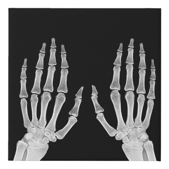 Skeleton Hands Xray Picture Human Anatomy photo  Faux Canvas Print (Front)