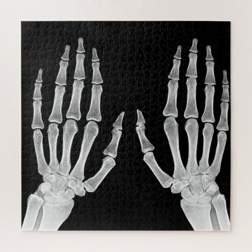 Skeleton Hands Xray Picture Human Anatomy photo Jigsaw Puzzle