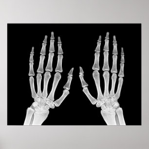 Skeleton Hands Xray Picture Human Anatomy photo  Poster