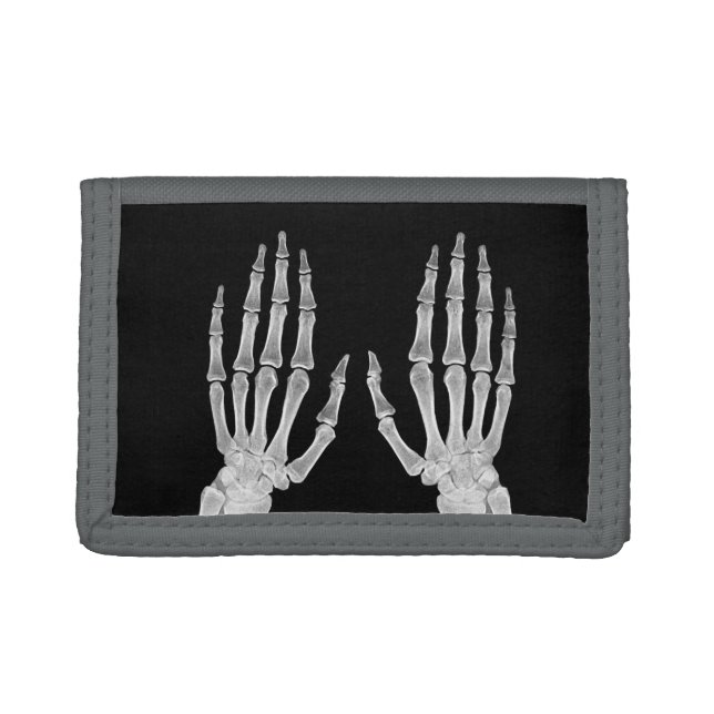 Skeleton Hands Xray Picture Human Anatomy photo  Trifold Wallet (Front)
