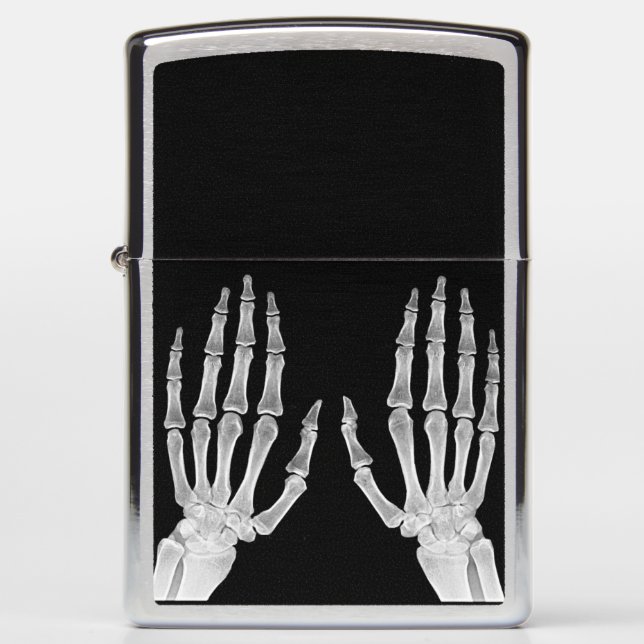 Skeleton Hands Xray Picture Human Anatomy photo  Zippo Lighter (Front)