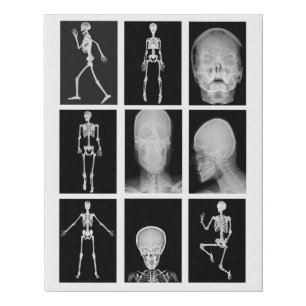 skeleton Skull Human Body XRAYS Collage art Faux Canvas Print