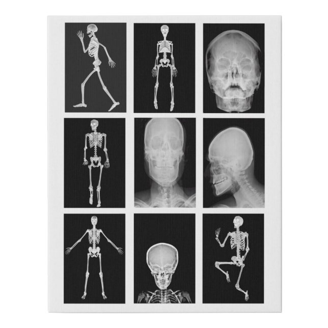 skeleton Skull Human Body XRAYS Collage art Faux Canvas Print (Front)