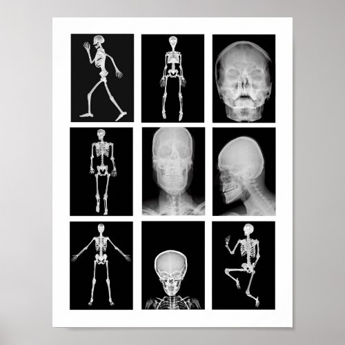 skeleton Skull Human Body XRAYS Collage art Poster