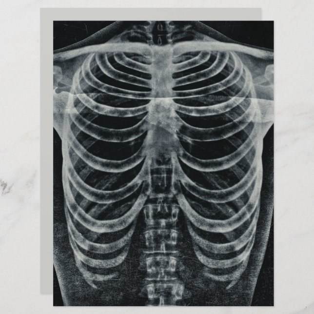 Skeleton Xray Rib Cage Vintage Black White Gothic (Front/Back)