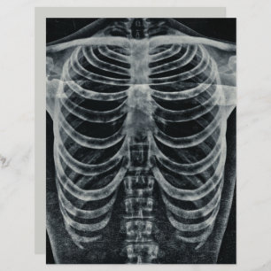 Skeleton Xray Rib Cage Vintage Black White Gothic