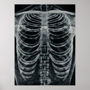 Skeleton Xray Rib Cage Vintage Black White Gothic Poster