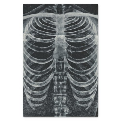 Skeleton Xray Rib Cage Vintage Black White Gothic Tissue Paper