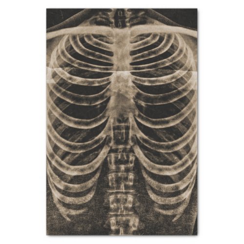 Skeleton Xray Rib Cage Vintage Sepia Black Gothic Tissue Paper