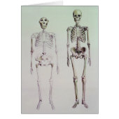 Skeletons of Australopithecus Boisei (Front)
