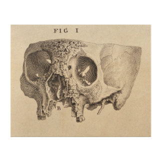 Skull - Antique Medical Illustration Wood Wall Decor