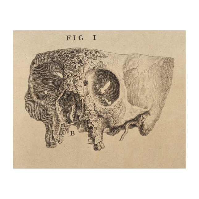 Skull - Antique Medical Illustration Wood Wall Decor (Front)