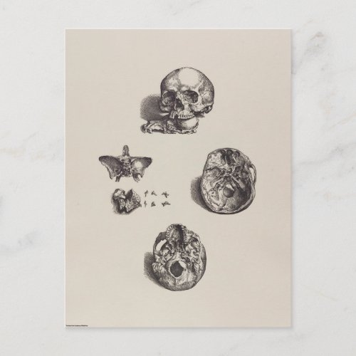 Skull _ Icones Anatomicae Postcard