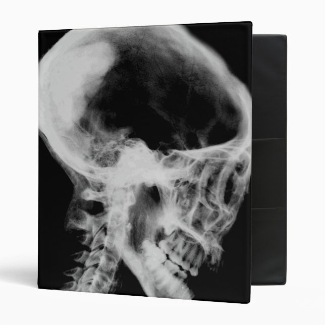Skull X-Ray Black & White 3 Ring Binder (Front/Inside)