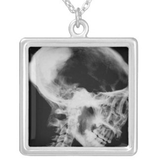 Skull X-Ray Black & White Sterling Silver Necklace
