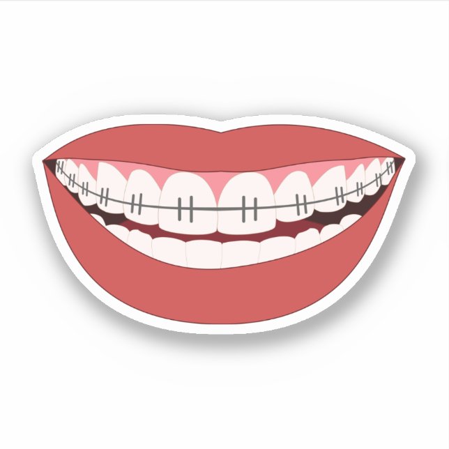 Smile Orthodontic Appliance Sticker (Front)
