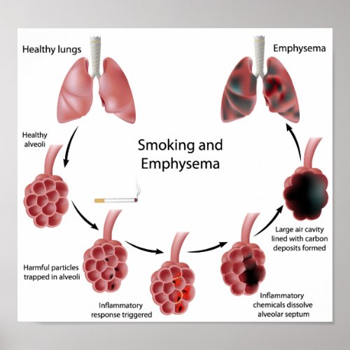 Smoking and emphysema  Poster
