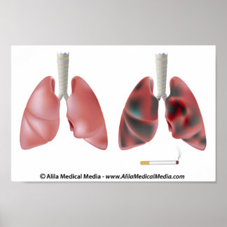 Health Anatomy Diseases Posters, Health Anatomy Diseases Prints, Art ...