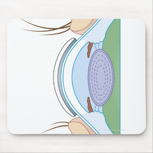 Soft Contact Lens Mouse Pad