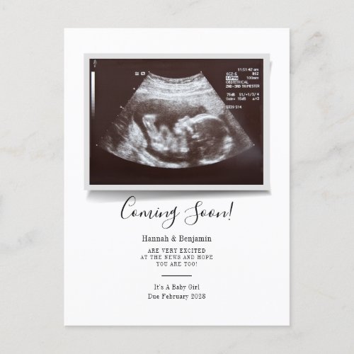 Sonogram Baby Scan Ultrasound Pregnancy Announcement Postcard