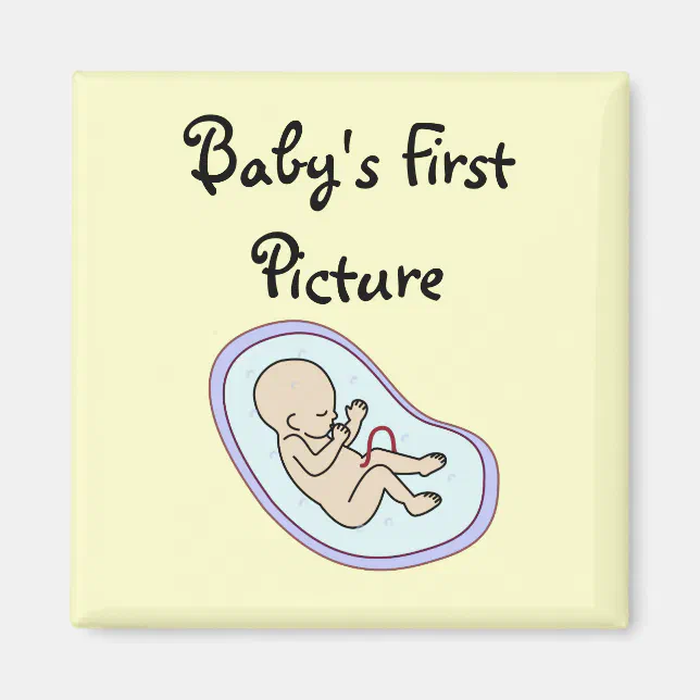 Sonogram Magnets