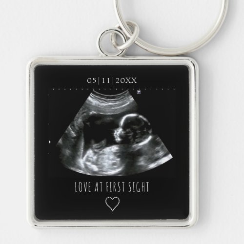 Sonogram Picture Photo Gift Baby Ultrasound Black Keychain