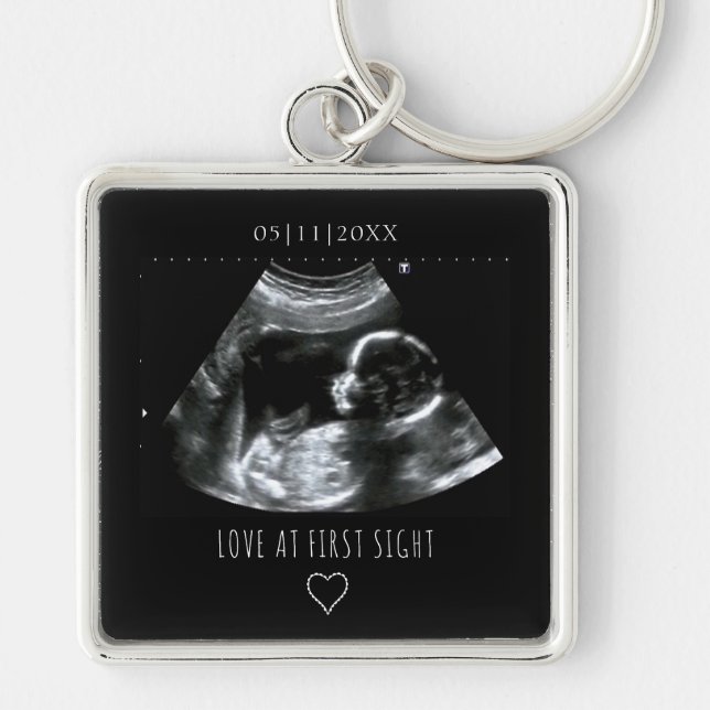 Sonogram Picture Photo Gift Baby Ultrasound Black Keychain (Front)