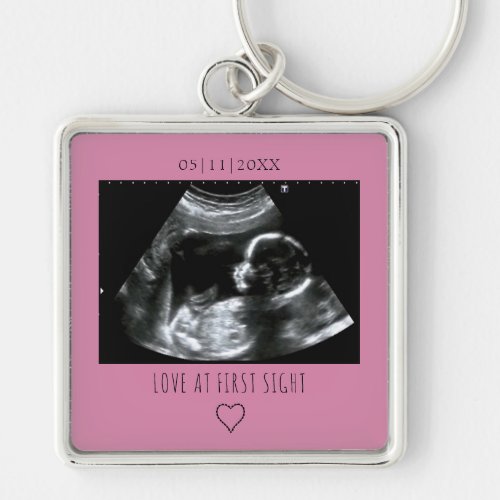 Sonogram Picture Photo Gift Baby Ultrasound Pink Keychain