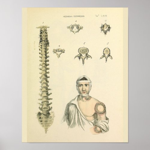 Spinal Column Vertebrae Anatomy Art Print