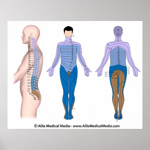 Spinal cord injury basis medical drawing poster