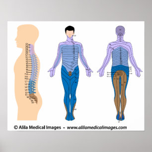 Spinal cord injury basis, medical drawing. poster