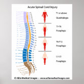 Anatomia Espinal Poster - Clinical Charts and Supplies