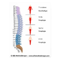 Spinal cord injury levels, labeled drawing. poster