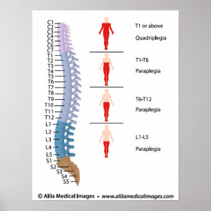 Spinal cord injury levels, labeled drawing. poster