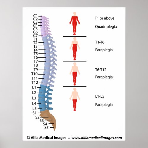 Spinal cord injury levels labeled drawing poster
