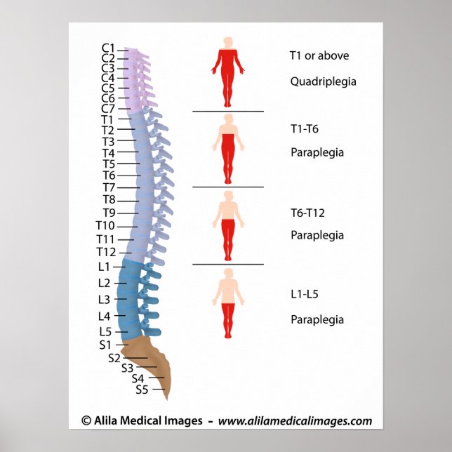 Spinal cord injury levels, labeled drawing. poster (Front)