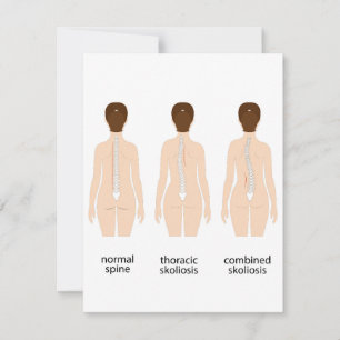 Spinal deformity note card