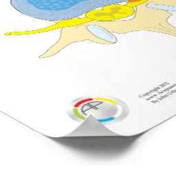 Spinal Disc Herniation Poster Medical Poster | Zazzle