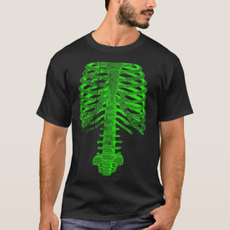 Spinal Tap x-ray T-Shirt