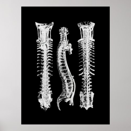 Spine Anatomy Art Poster