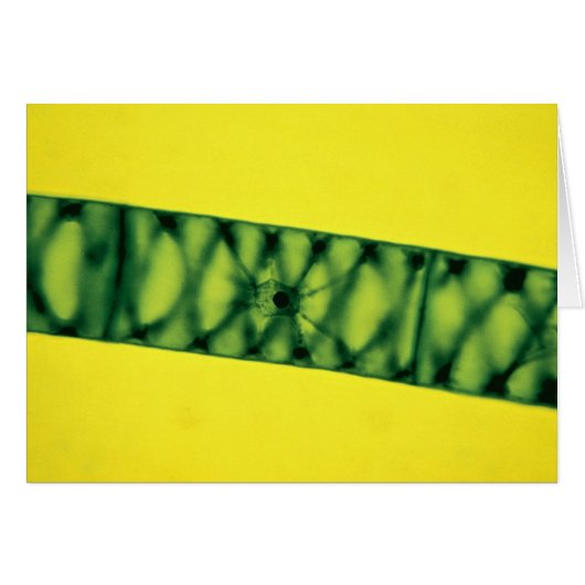Spirogyra Green Algae Cards (Front Horizontal)