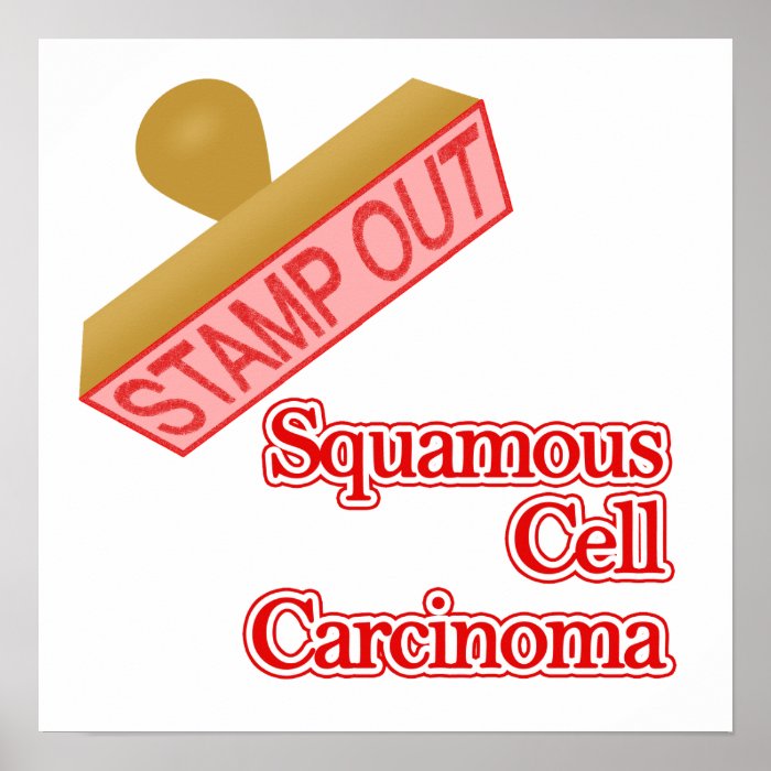 Squamous Cell Carcinoma Poster