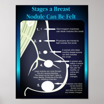 Stages A Breast Nodule Can Be Felt Poster by iambandc_art at Zazzle
