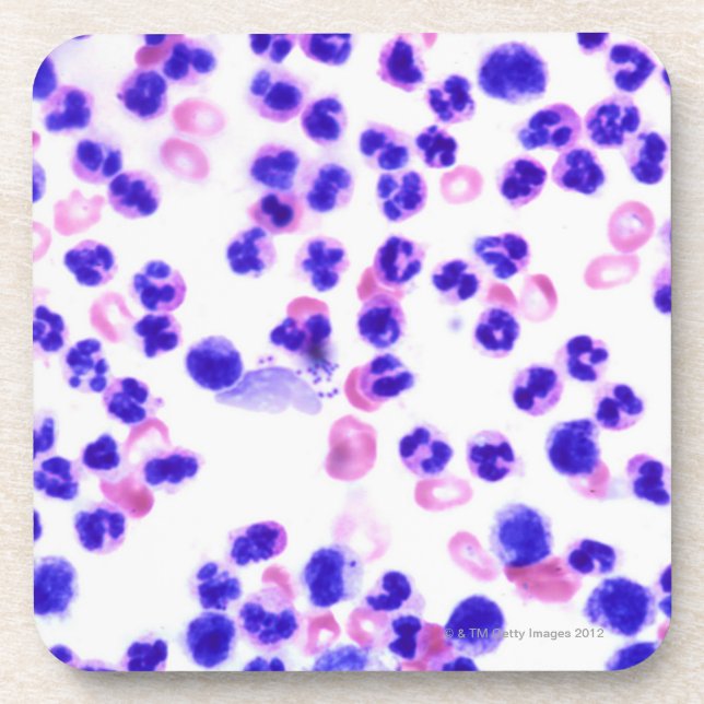 Staph Infection Coaster (Front)